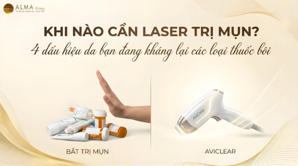 Mụn Nội Tiết: Khi Nào Bạn Cần Chuyển Sang Laser Công Nghệ Cao?