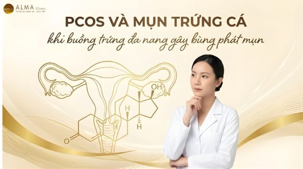 PCOS Và Mụn Trứng Cá: Mối Liên Hệ Trực Tiếp [Bác Sĩ Da Liễu]