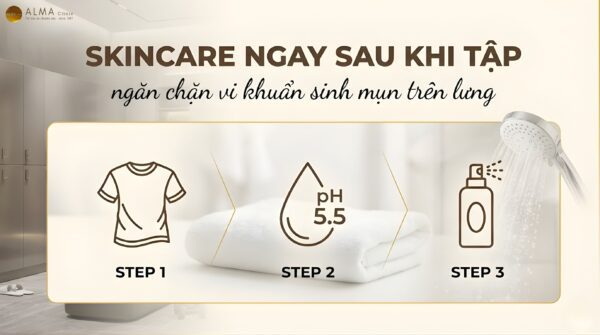 Quy Trình Chăm Sóc Da Lưng Sau Tập Thể Thao Để Ngăn Ngừa Mụn [2026]