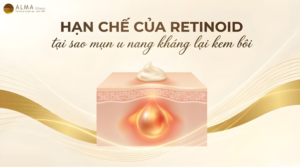Retinoid Không Trị Được Mụn U Nang — Vì Sao? [Giải Pháp Thay Thế]