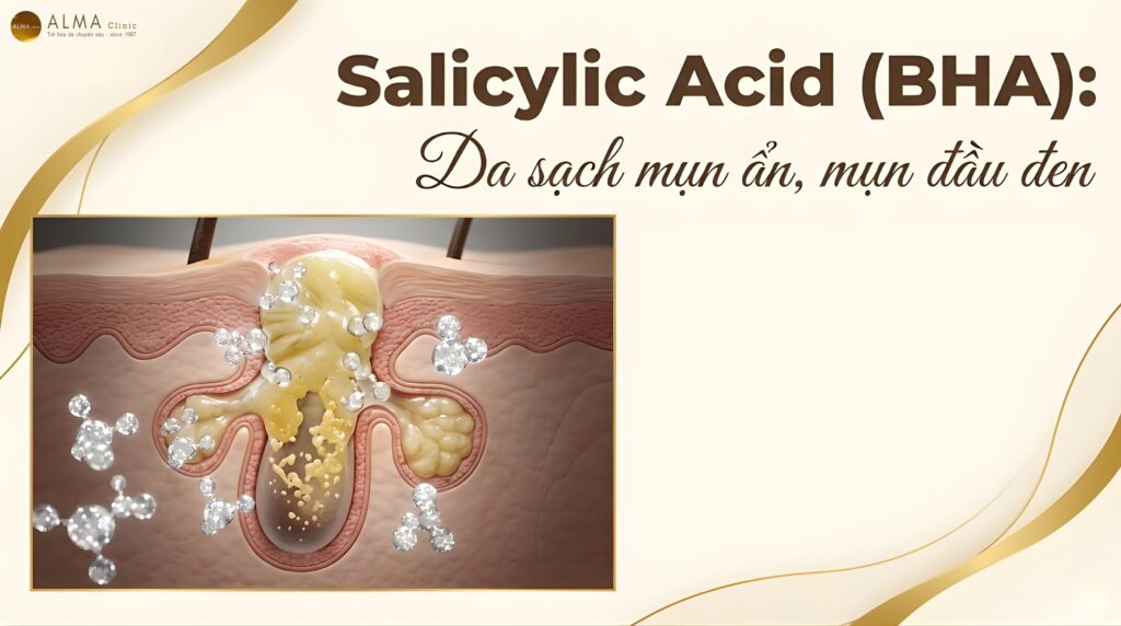 Salicylic Acid (BHA) Có Trị Được Mụn Ẩn Và Mụn Đầu Đen Không?
