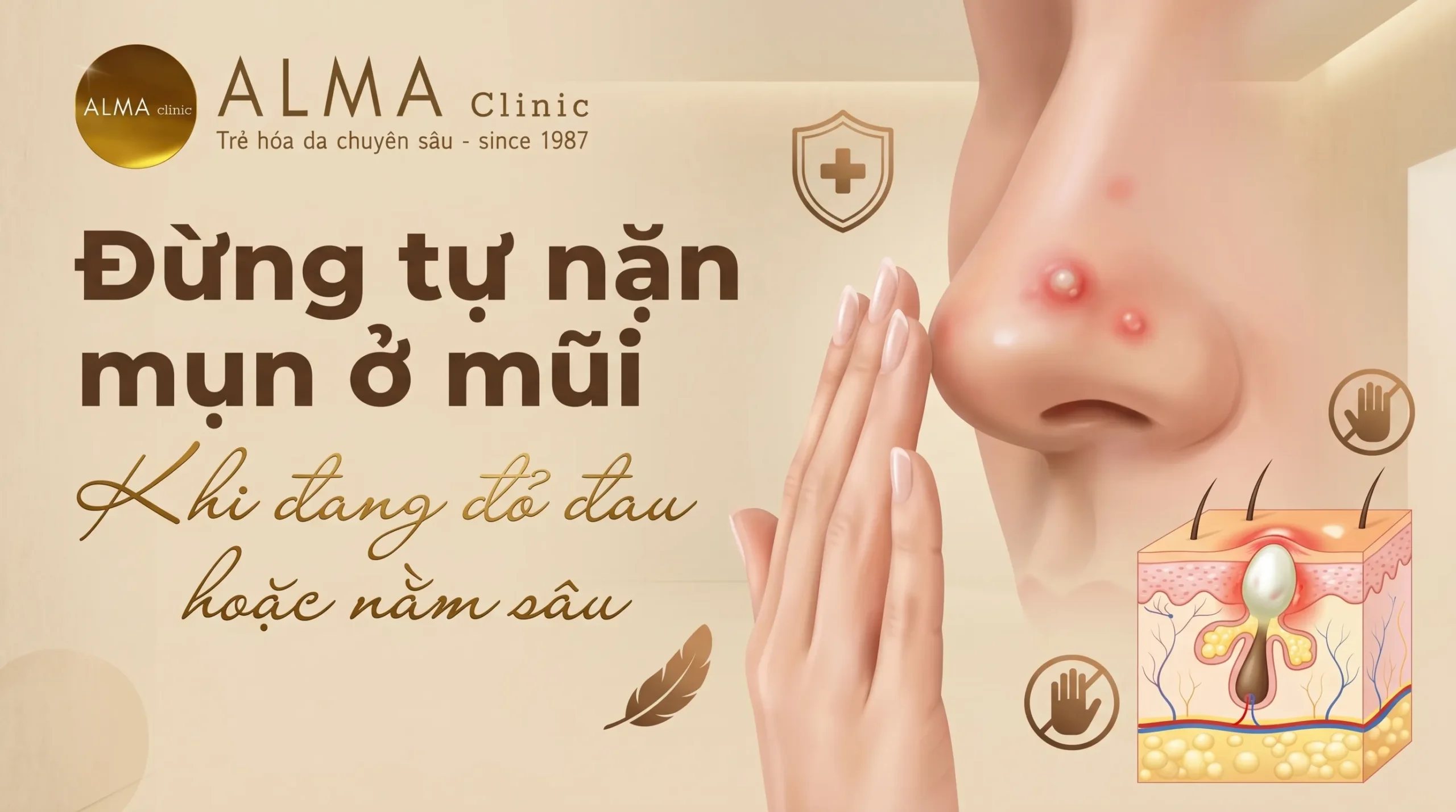 khong tu nan mun viem o mui scaled Không tự nặn mụn viêm ở mũi khi đau sâu đỏ lan