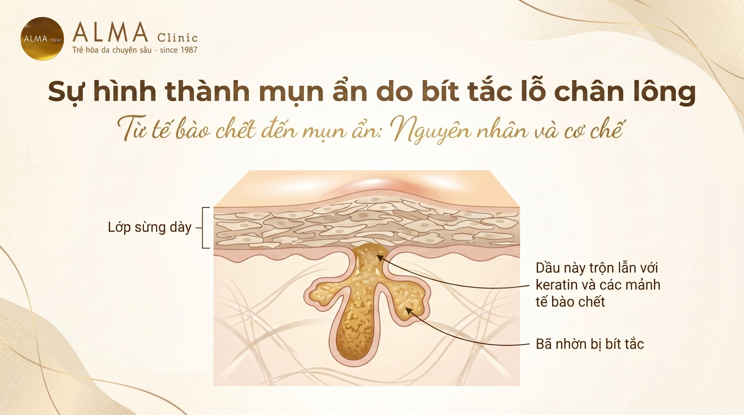 bac si danh gia mun an lop sung day scaled Bác sĩ da liễu đánh giá da sần mụn ẩn trước khi chọn hướng xử trí
