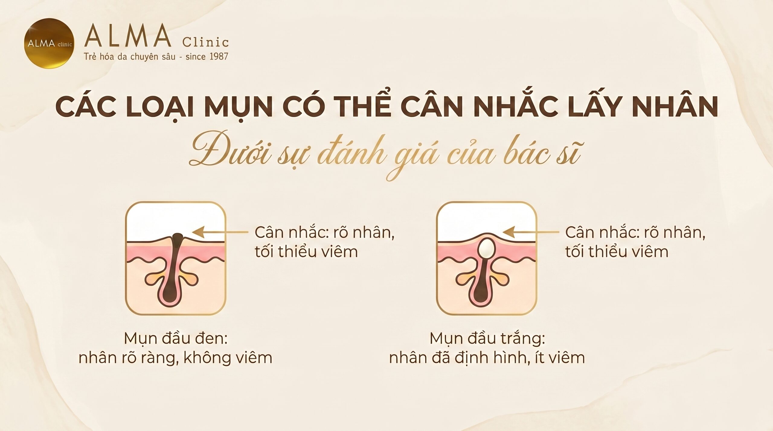 cac loai mun co the can nhac lay nhan scaled Các loại mụn có thể cân nhắc lấy nhân dưới đánh giá y khoa