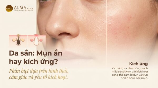 Da sần li ti có thể là mụn ẩn hoặc kích ứng da