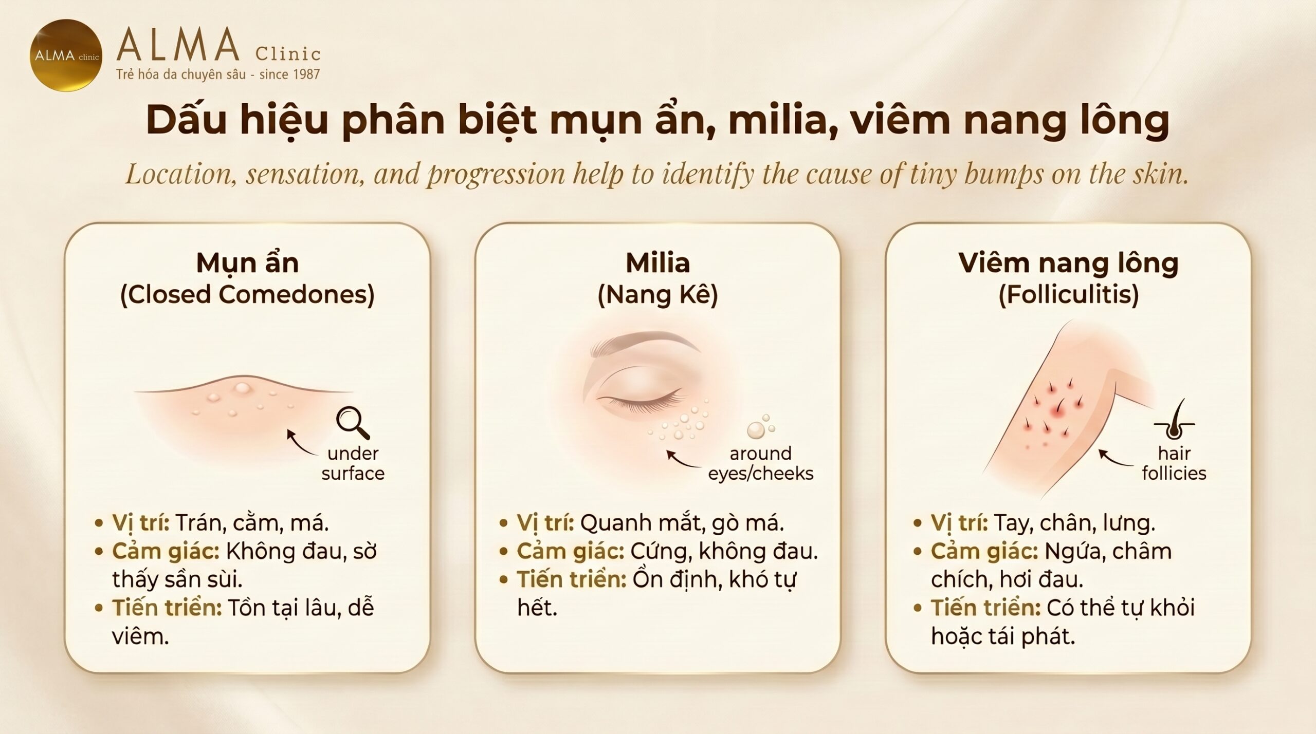 dau hieu phan biet mun an milia viem nang long scaled Dấu hiệu phân biệt mụn ẩn, mụn kê và viêm nang lông