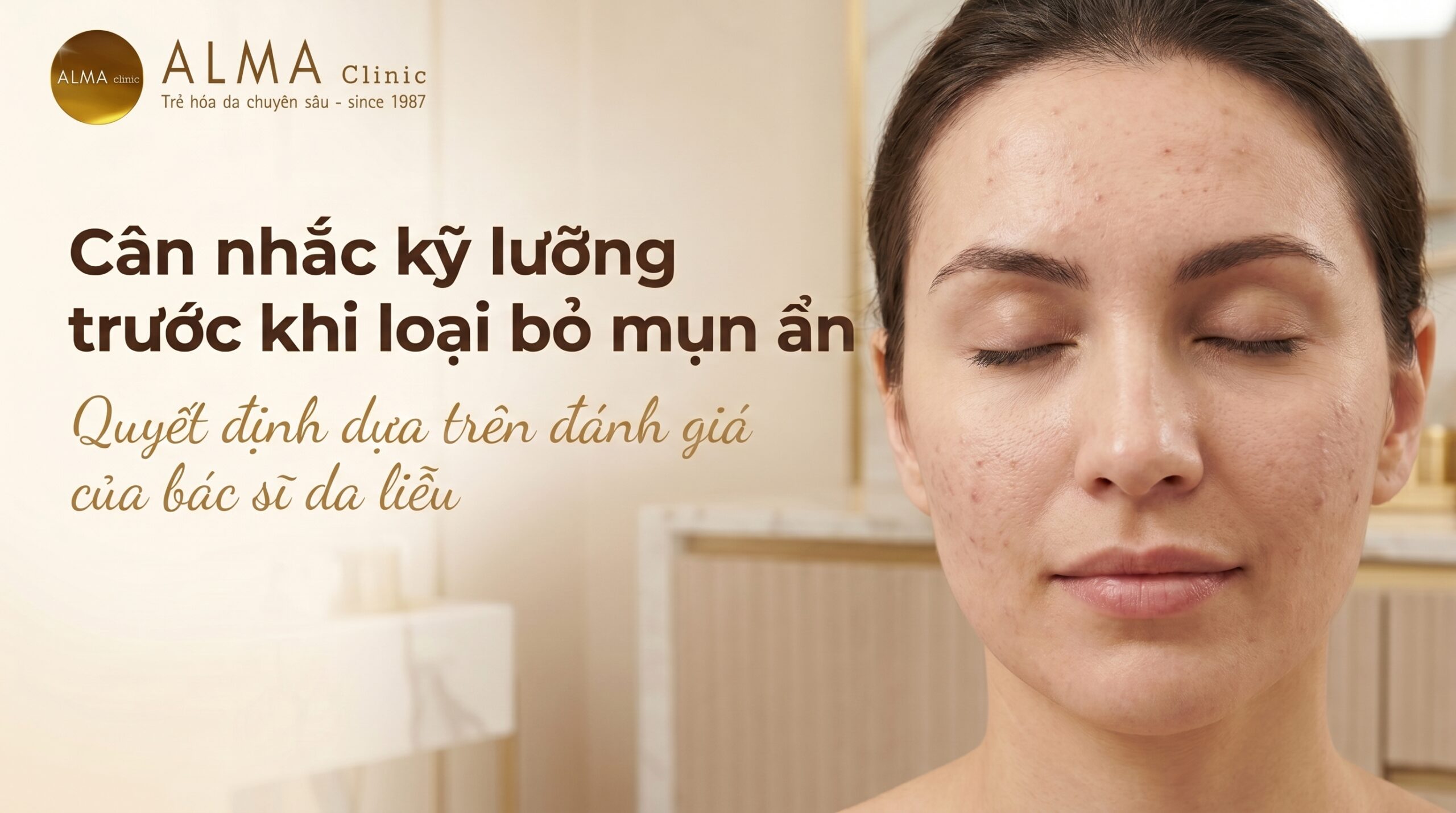 khi nao co the can nhac lay nhan mun an scaled Khi nào có thể cân nhắc lấy nhân mụn ẩn