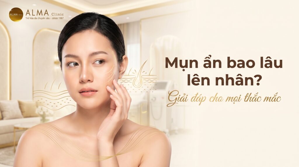 mun an bao lau len nhan 1 Minh họa mụn ẩn dưới da không có mốc cố định để lên nhân