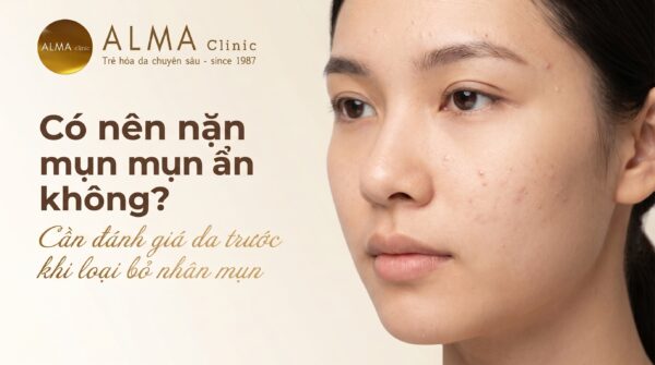 Mụn ẩn có nên nặn không và khi nào cần bác sĩ da liễu đánh giá