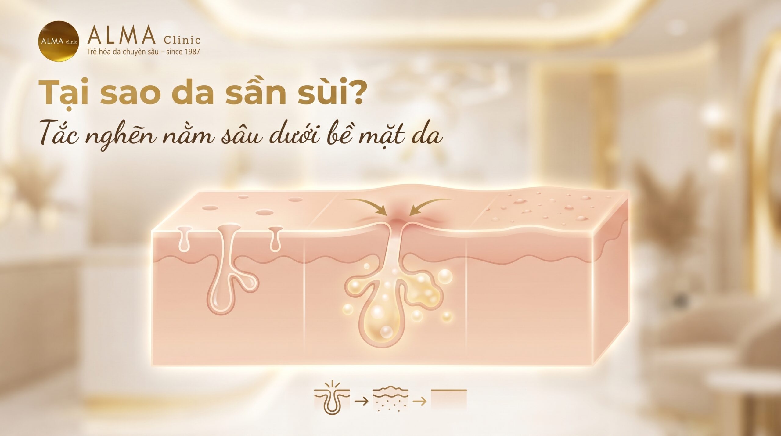 vi sao da san khong thay dau mun 1 scaled Da sần nhưng không thấy đầu mụn do bít tắc dưới bề mặt da