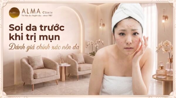 soi da trước trị mụn tại Alma Clinic